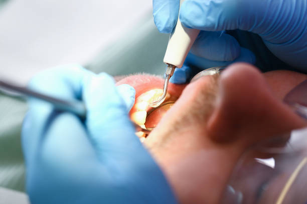 Best Broken or Cracked Tooth Emergency Dentist in Westlake, TX